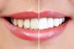 Periodoncia y estética