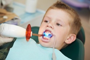 Tratamiento de caries